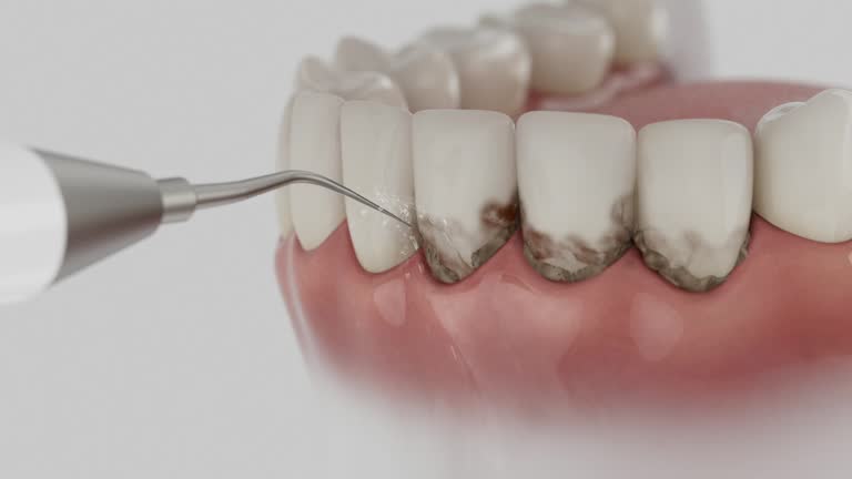 Reliable Dental Implants contractor in Cottage Grove, WI by Smile Center Dentistry